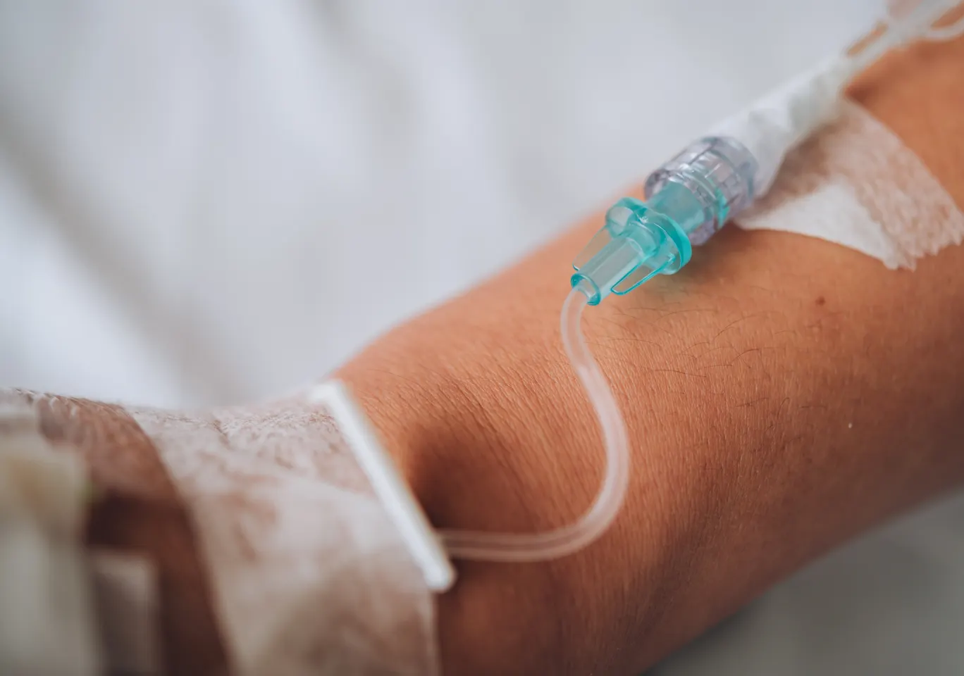 Kroplówki witaminowe Lubień Kujawski: wenflon oklejony na przedramieniu podczas wlewu
